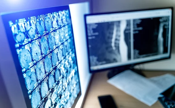 Medical images on screens